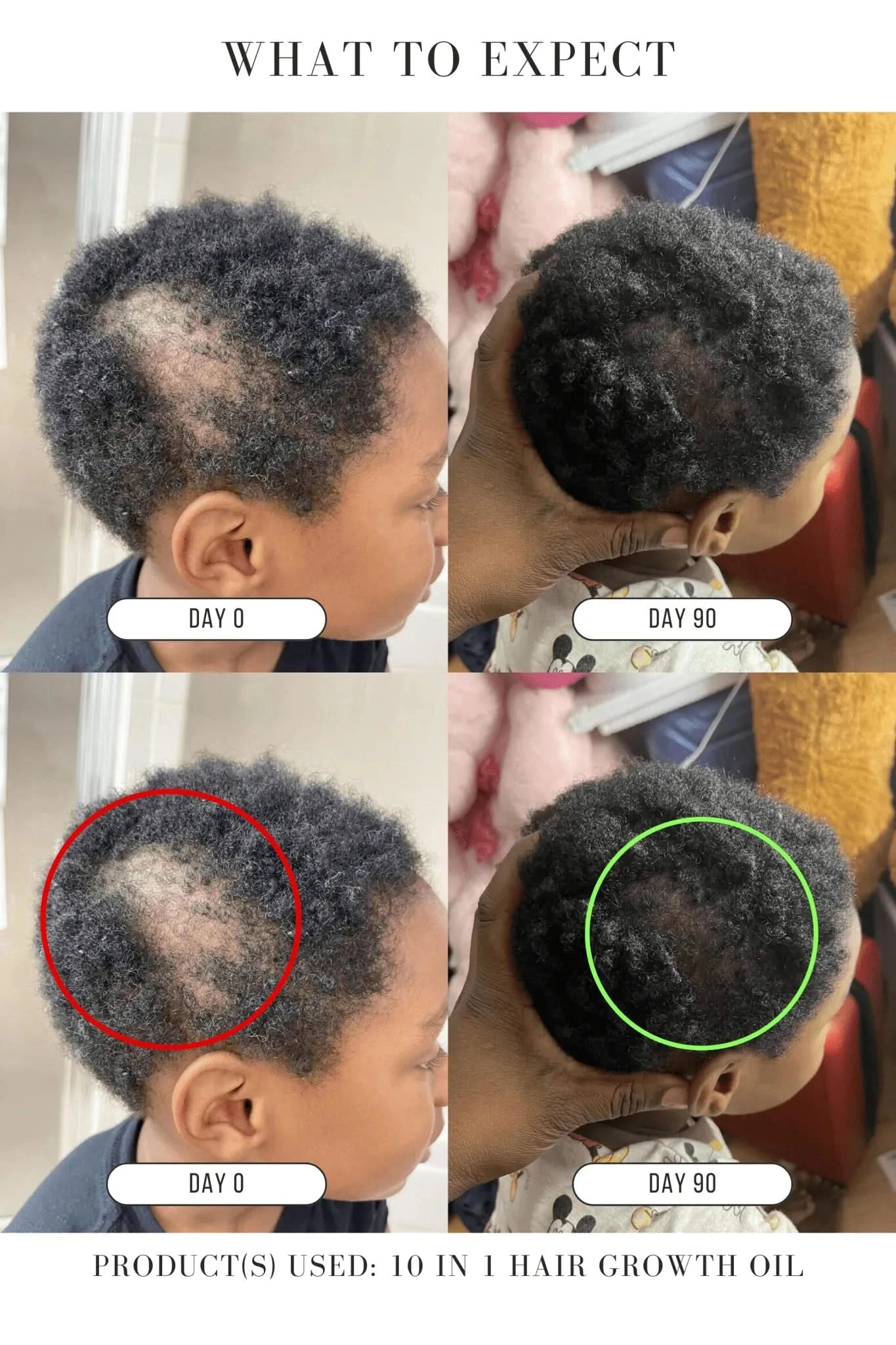⚡Botanical Hair Revival – 100% Natural Growth Oil with Chebe & Biotin