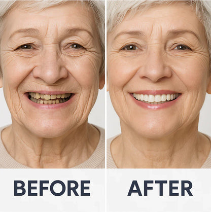 Custom-Fit Functional Dentures🦷