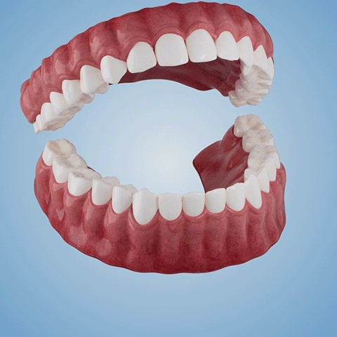🦷 𝗠𝗲𝗱𝗶𝗰𝗮𝗹-𝗚𝗿𝗮𝗱𝗲 𝗙𝘂𝗻𝗰𝘁𝗶𝗼𝗻𝗮𝗹 𝗧𝗵𝗶𝗰𝗸𝗲𝗻𝗲𝗱 𝗗𝗲𝗻𝘁𝘂𝗿𝗲𝘀🗽𝗠𝗮𝗱𝗲 𝗜𝗻 𝗧𝗵𝗲 𝗨𝗦𝗔👏