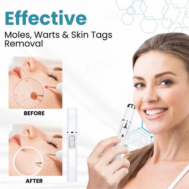 [⚡️BEST DEAL TODAY]🔥Non-Invasive Mole and Wart Removal Laser Pen